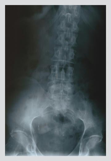 Lower Spine 20x30 poster